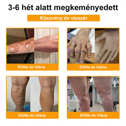 𝑿𝑹𝑳𝑿𝑹𝑳®🧑‍⚕️ Botulinum Toxin és Méhméreg Fájdalomcsillapító Csontgyógyító Krém (Felnőttek és idősek számára)