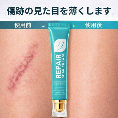 ✨Fountain Berryクリーム🌿| 古い・新しい傷跡、火傷やその他の肌トラブルに