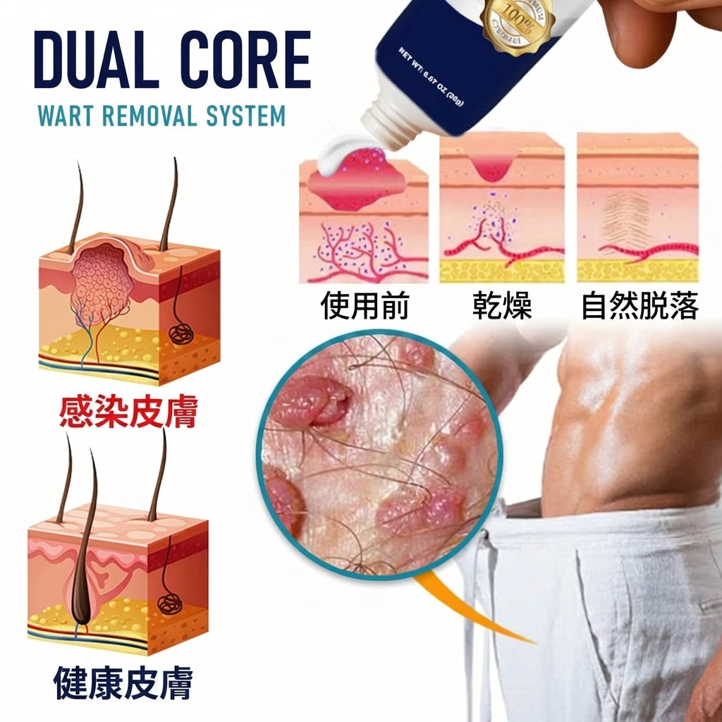 Fountain Berry® 男性用イボ除去クリーム 👨 男性向けに設計