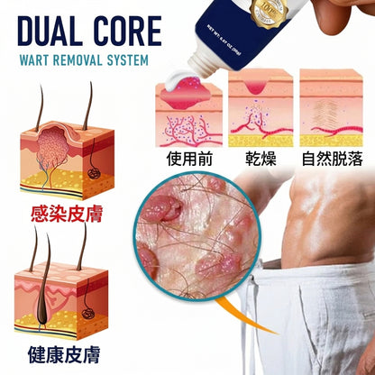 Fountain Berry® 男性用イボ除去クリーム 👨 男性向けに設計