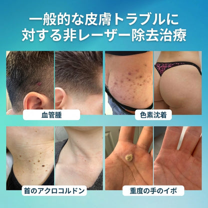 Fountain Berry® SpotlessPro アドバンストスキンケアペン