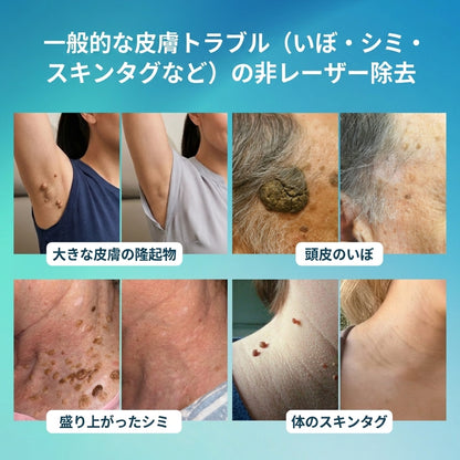 Fountain Berry® SpotlessPro アドバンストスキンケアペン