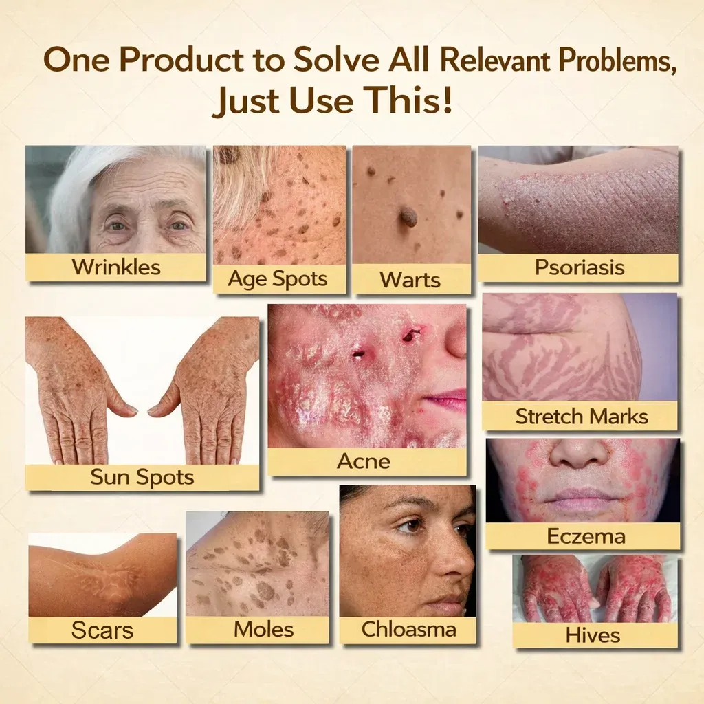 【𝐿𝑎𝑠𝑡 𝐷𝑎𝑦 𝑃𝑟𝑜𝑚𝑜𝑡𝑖𝑜𝑛 70% 𝑂𝐹𝐹】𝒀𝑰𝑻𝑶𝑾𝑨𝒀™ 𝑇𝑎𝑙𝑙𝑜𝑤 & 𝐵𝑒𝑒 𝑉𝑒𝑛𝑜𝑚 𝑅𝑒𝑝𝑎𝑖𝑟 𝐶𝑟𝑒𝑎𝑚（for acne, wrinkles, and damaged skin — steroid-free）