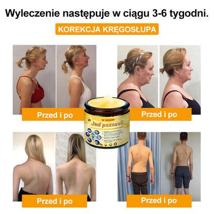 ADNOON® Krem Przeciwobrzękowy i Przeciwbólowy z Jadem Pszczelim