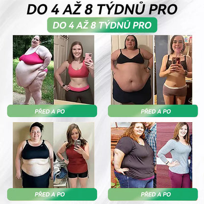 🌿 Oficiální obchod ČR | STDEI® GLP-1 8-v-1 Fit &amp; Vital Řešení (Jednou denně, viditelné změny za 7 dní) ✅ Obezita, kardiovaskulární zdraví, cukrovka, spánková apnoe, zdraví střev, problémy se klouby a další.