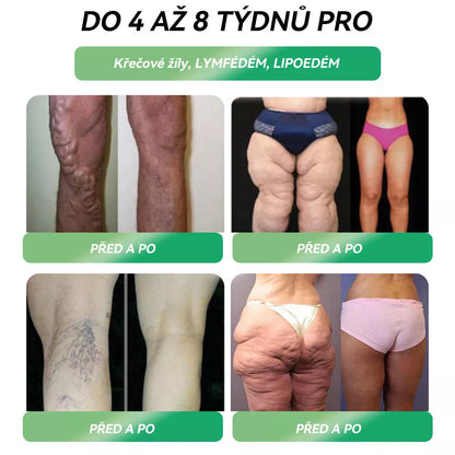 🌿 Oficiální obchod ČR | STDEI® GLP-1 8-v-1 Fit &amp; Vital Řešení (Jednou denně, viditelné změny za 7 dní) ✅ Obezita, kardiovaskulární zdraví, cukrovka, spánková apnoe, zdraví střev, problémy se klouby a další.