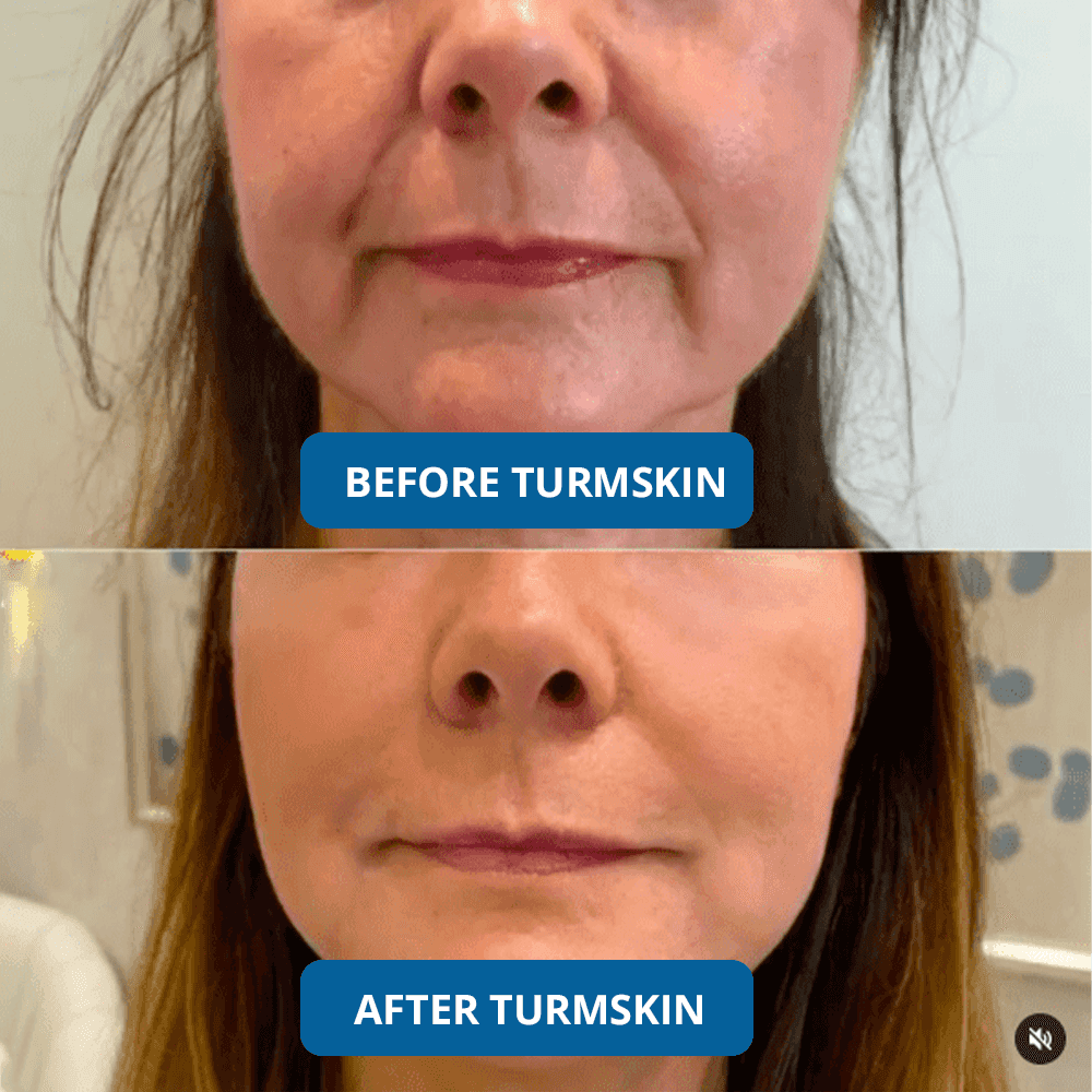 3% Hyaluronic Acid Ultra Hydrating Serum