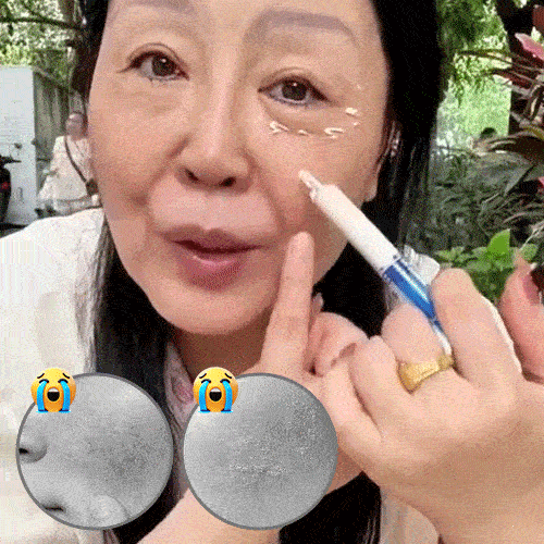 "Look 10 Years Younger in a Second" Anti-Wrinkle Cream