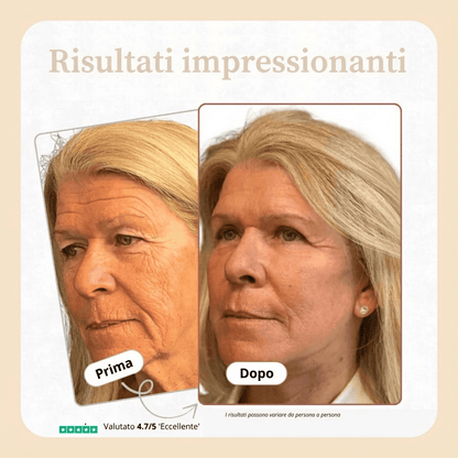 Stick Antirughe al Calcio – Ringiovanisce e Rassoda il Viso | Formula al Calcio + Collagene con Complesso Ribornic Brevettato