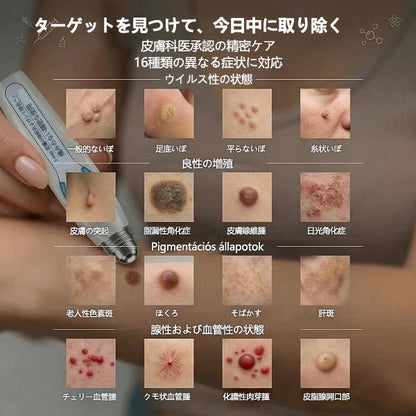 公式ストア🎉7 日間ピンポイントケアローラー 痛みなし・傷跡残らないタイプ