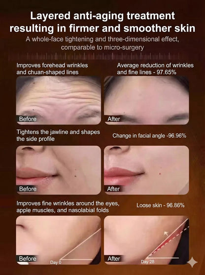 "Look 10 Years Younger in a Second" Anti-Wrinkle Cream