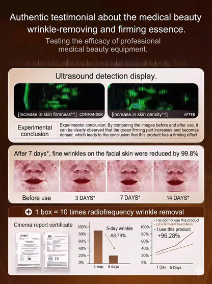 "Look 10 Years Younger in a Second" Anti-Wrinkle Cream