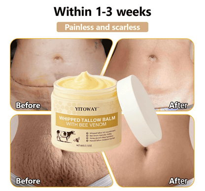 【𝐿𝑎𝑠𝑡 𝐷𝑎𝑦 𝑃𝑟𝑜𝑚𝑜𝑡𝑖𝑜𝑛 70% 𝑂𝐹𝐹】𝒀𝑰𝑻𝑶𝑾𝑨𝒀™ 𝑇𝑎𝑙𝑙𝑜𝑤 & 𝐵𝑒𝑒 𝑉𝑒𝑛𝑜𝑚 𝑅𝑒𝑝𝑎𝑖𝑟 𝐶𝑟𝑒𝑎𝑚（for acne, wrinkles, and damaged skin — steroid-free）