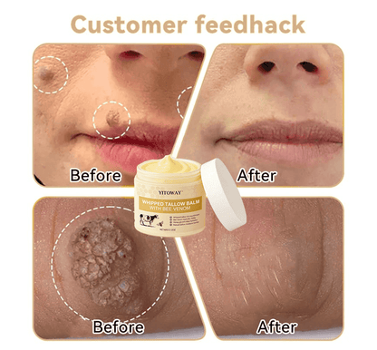 【𝐿𝑎𝑠𝑡 𝐷𝑎𝑦 𝑃𝑟𝑜𝑚𝑜𝑡𝑖𝑜𝑛 70% 𝑂𝐹𝐹】𝒀𝑰𝑻𝑶𝑾𝑨𝒀™ 𝑇𝑎𝑙𝑙𝑜𝑤 & 𝐵𝑒𝑒 𝑉𝑒𝑛𝑜𝑚 𝑅𝑒𝑝𝑎𝑖𝑟 𝐶𝑟𝑒𝑎𝑚（for acne, wrinkles, and damaged skin — steroid-free）