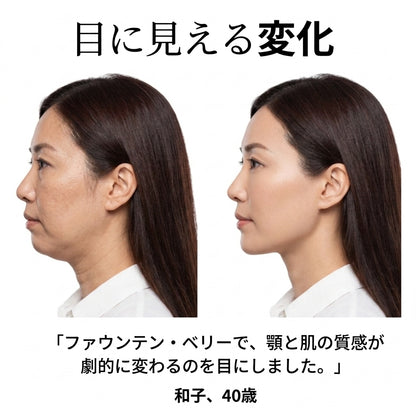 【公式】フォンテンベリー EMSリフトアップベルト ～赤色LED×温熱トリプルケアでフェイスライン引き締め～
