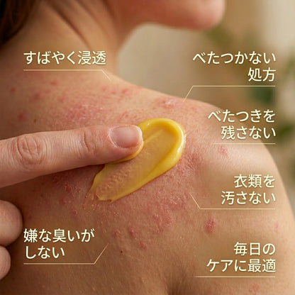 ハーブ処方の乾癬・湿疹ケアクリーム