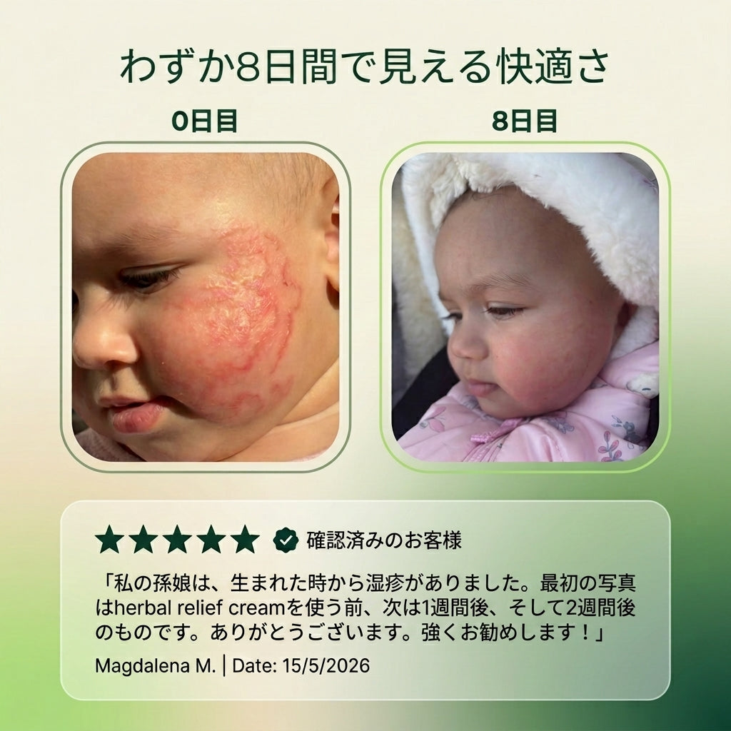 ハーブ処方の乾癬・湿疹ケアクリーム