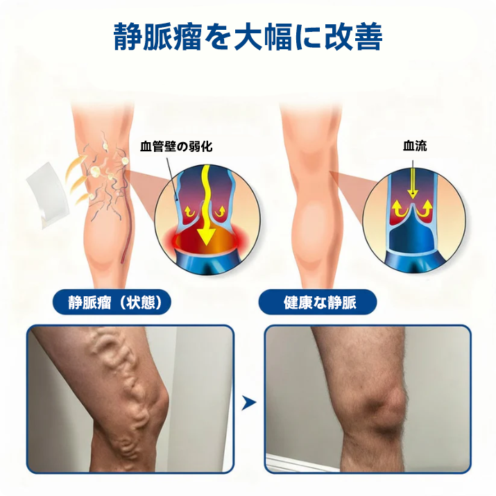 🇯🇵👨‍⚕️✅TAILEDEN® VeinEase マイクロニードルパッチ⚡すぐに実感、長く続く効果