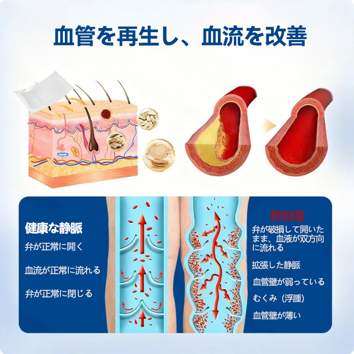🇯🇵👨‍⚕️✅TAILEDEN® VeinEase マイクロニードルパッチ⚡すぐに実感、長く続く効果