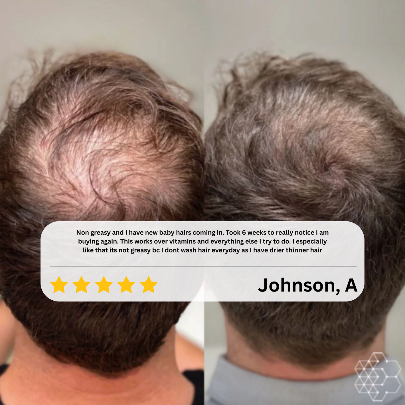 Babdmise HairRevive™ Roll on System