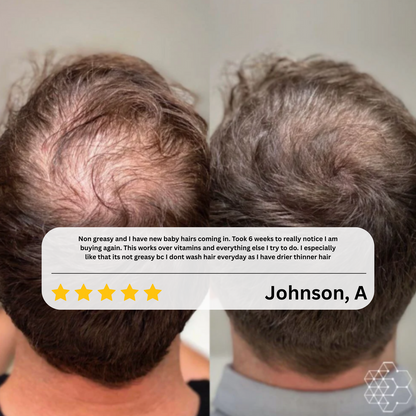 Babdmise HairRevive™ Roll on System