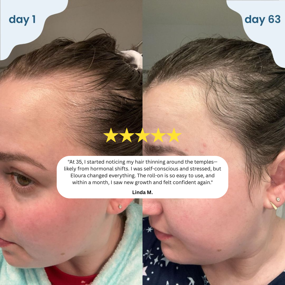 Babdmise HairRevive™ Roll on System